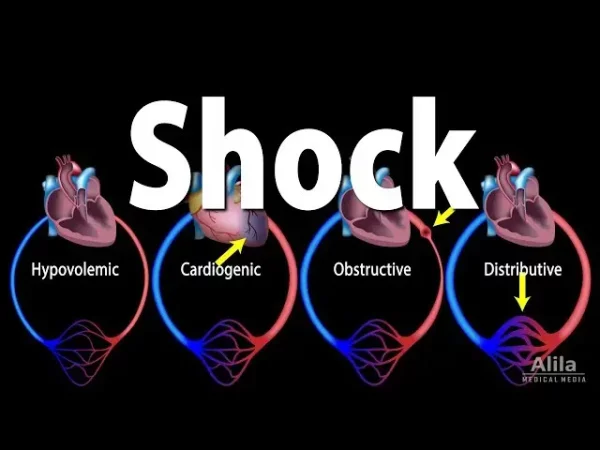 SHOCK