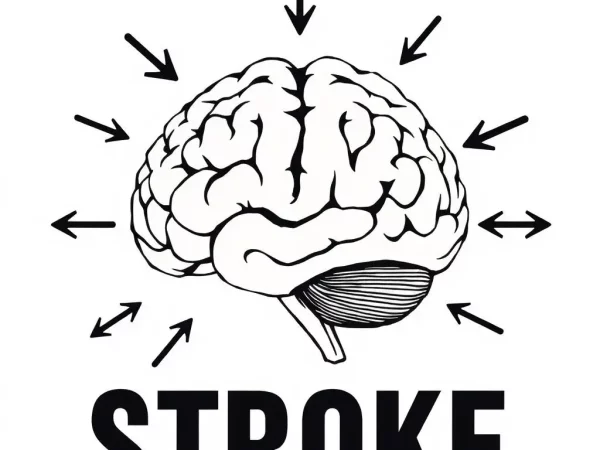 stroke