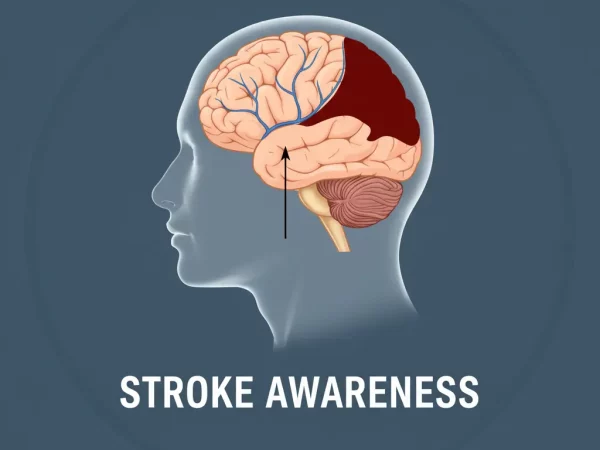 stroke